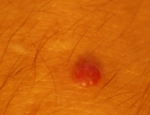 axli-2