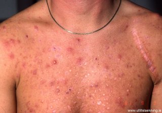 copy_0_mynd-7