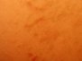 Pseudoacanthosis nigricans
